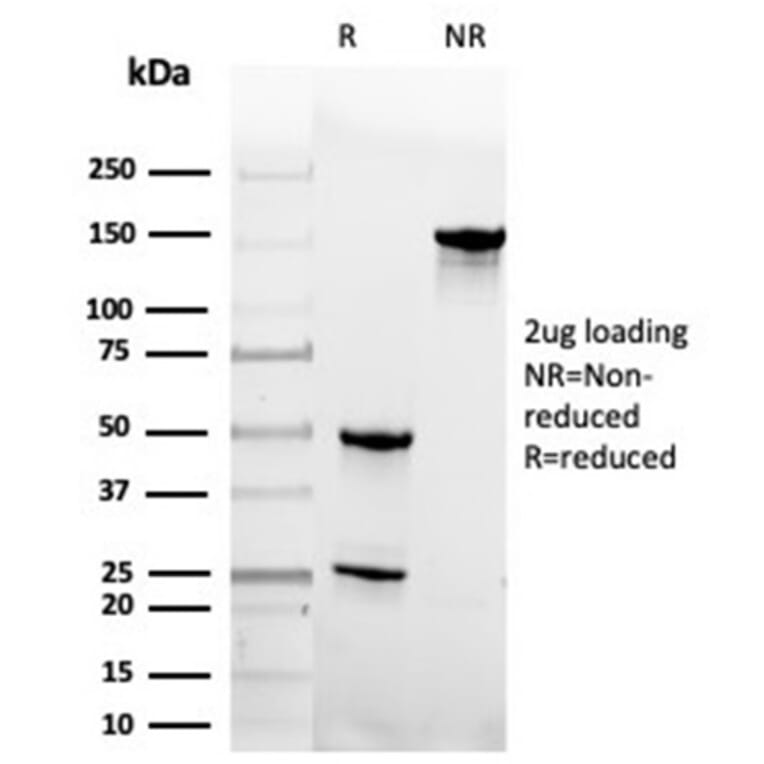 SDS-PAGE - Anti-Geminin Antibody [GMNN/4033] (A277735) - Antibodies.com