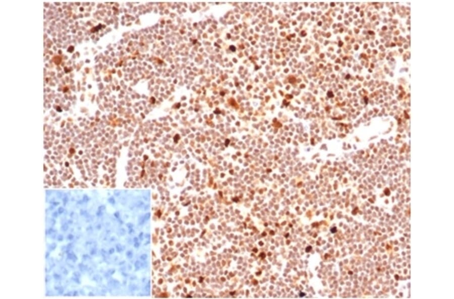 Immunohistochemistry - Anti-PCNA Antibody [PCNA/6580] (A277736) - Antibodies.com