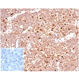 Immunohistochemistry - Anti-PCNA Antibody [PCNA/6580] (A277736) - Antibodies.com