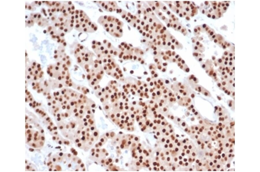 Immunohistochemistry - Anti-PCNA Antibody [PCNA/6580] (A277736) - Antibodies.com