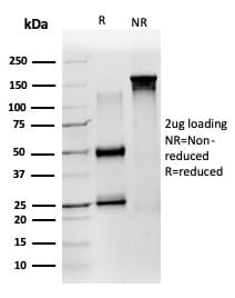 SDS-PAGE analysis of Anti-ZNF639 Antibody [PCRP-ZNF639-2B2] under non-reduced and reduced conditions; showing intact IgG and intact heavy and light chains, respectively. SDS-PAGE analysis confirms the integrity and purity of the antibody.