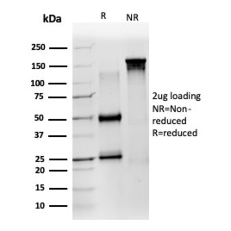 SDS-PAGE - Anti-ZNF639 Antibody [PCRP-ZNF639-2B2] (A277737) - Antibodies.com