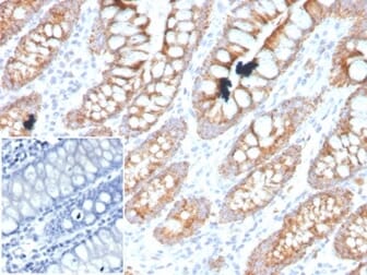 Immunohistochemical analysis of formalin-fixed, paraffin-embedded human colon tissue using Anti-PDGFB Antibody [PDGFB/3071]. Inset: PBS instead of the primary antibody. Secondary antibody negative control.