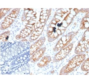 Immunohistochemistry - Anti-PDGFB Antibody [PDGFB/3071] (A277738) - Antibodies.com