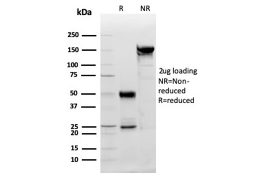 SDS-PAGE - Anti-PDGFB Antibody [PDGFB/3071] (A277738) - Antibodies.com