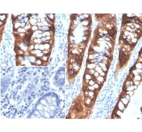 Immunohistochemistry - Anti-PDGFB Antibody [PDGFB/3072] (A277739) - Antibodies.com