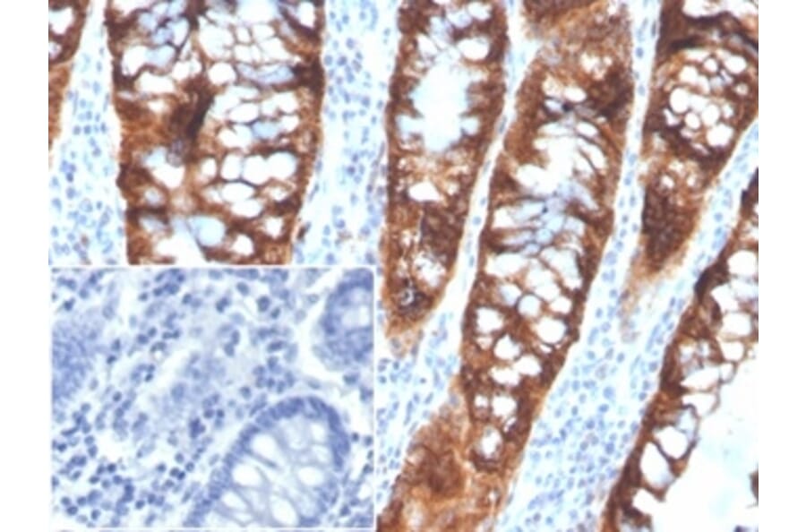 Immunohistochemistry - Anti-PDGFB Antibody [PDGFB/3072] (A277739) - Antibodies.com