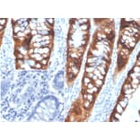 Immunohistochemistry - Anti-PDGFB Antibody [PDGFB/3072] (A277739) - Antibodies.com