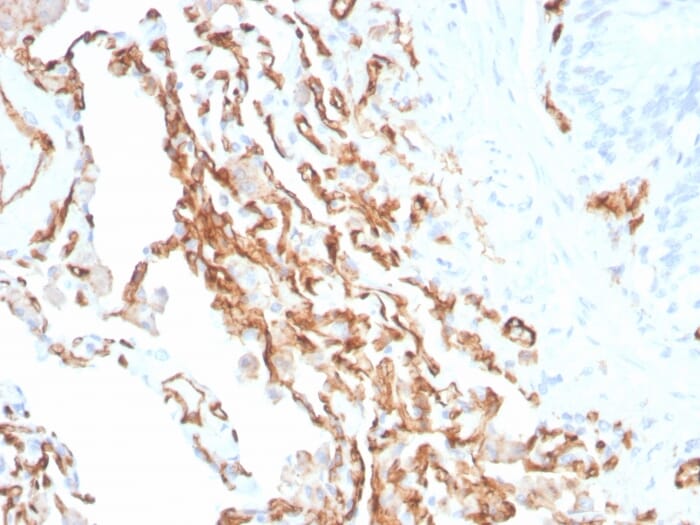 Immunohistochemical analysis of formalin-fixed, paraffin-embedded human colon tissue using Anti-CD31 Antibody [PECAM1/3534].