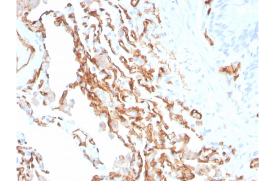Immunohistochemistry - Anti-CD31 Antibody [PECAM1/3534] (A277740) - Antibodies.com