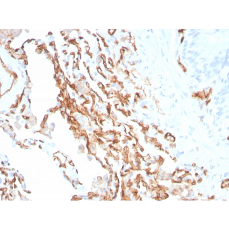 Immunohistochemistry - Anti-CD31 Antibody [PECAM1/3534] (A277740) - Antibodies.com