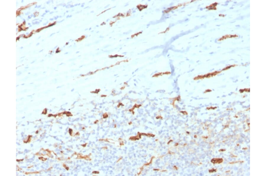 Immunohistochemistry - Anti-CD31 Antibody [PECAM1/3534] (A277740) - Antibodies.com
