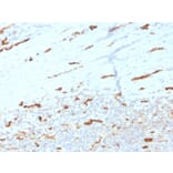 Immunohistochemistry - Anti-CD31 Antibody [PECAM1/3534] (A277740) - Antibodies.com