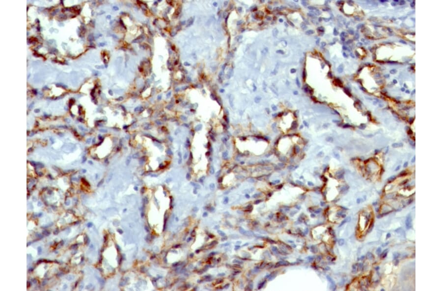 Immunohistochemistry - Anti-CD31 Antibody [C31.3 + JC/70A] (A277741) - Antibodies.com