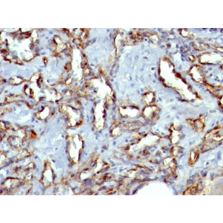 Immunohistochemistry - Anti-CD31 Antibody [C31.3 + JC/70A] (A277741) - Antibodies.com