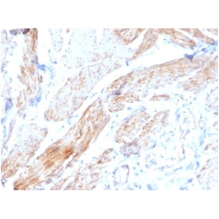 Immunohistochemistry - Anti-Phosphoglucomutase 5 Antibody [PGM5/3552] (A277742) - Antibodies.com