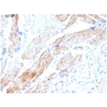Immunohistochemistry - Anti-Phosphoglucomutase 5 Antibody [PGM5/3552] (A277742) - Antibodies.com