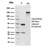 SDS-PAGE - Anti-Phosphoglucomutase 5 Antibody [PGM5/3552] (A277742) - Antibodies.com