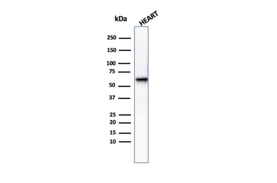 Western Blot - Anti-Phosphoglucomutase 5 Antibody [PGM5/3552] (A277742) - Antibodies.com
