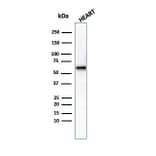 Western Blot - Anti-Phosphoglucomutase 5 Antibody [PGM5/3552] (A277742) - Antibodies.com