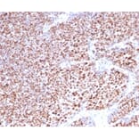 Immunohistochemistry - Anti-Progesterone Receptor Antibody [PGR/3817] (A277743) - Antibodies.com