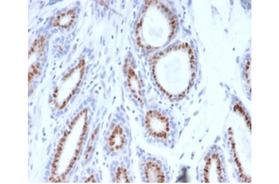 Immunohistochemistry - Anti-Progesterone Receptor Antibody [PGR/3817] (A277743) - Antibodies.com
