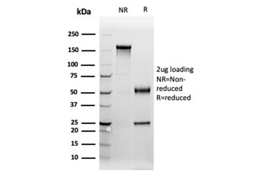 SDS-PAGE - Anti-Progesterone Receptor Antibody [PGR/3817] (A277743) - Antibodies.com