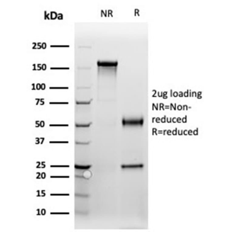 SDS-PAGE - Anti-Progesterone Receptor Antibody [PGR/3817] (A277743) - Antibodies.com