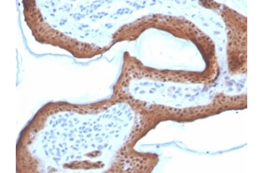 Immunohistochemistry - Anti-Maspin Antibody [SERPINB5/4972] (A277744) - Antibodies.com