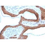 Immunohistochemistry - Anti-Maspin Antibody [SERPINB5/4972] (A277744) - Antibodies.com