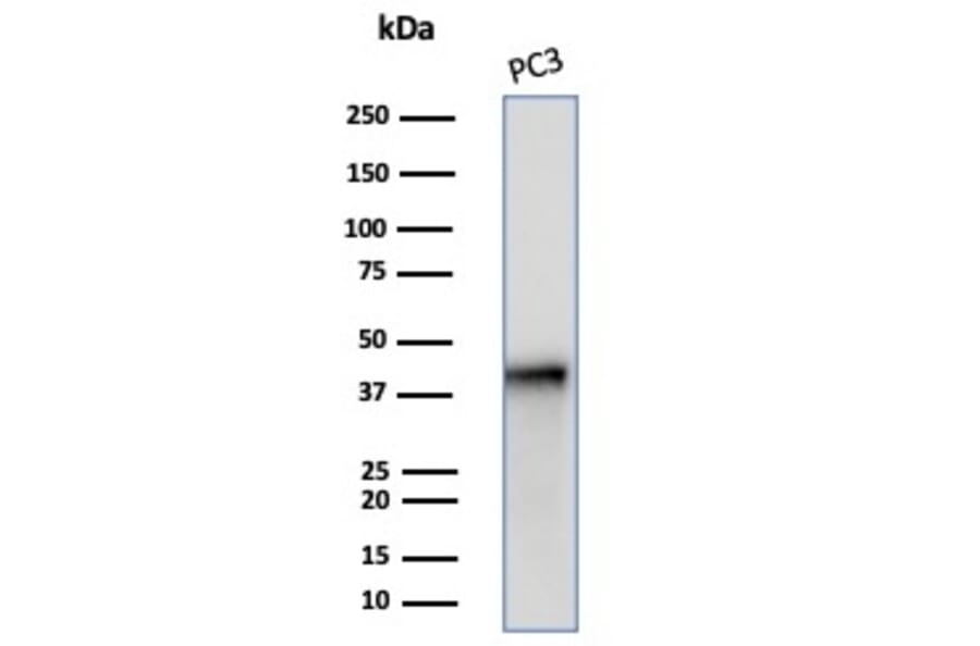 Western Blot - Anti-Maspin Antibody [SERPINB5/4972] (A277744) - Antibodies.com