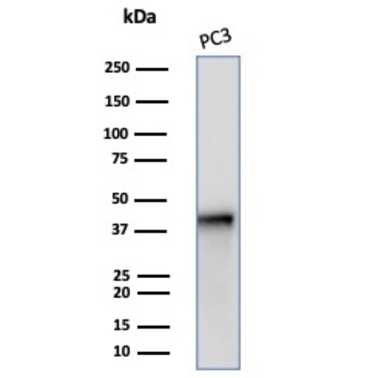 Western Blot - Anti-Maspin Antibody [SERPINB5/4972] (A277744) - Antibodies.com