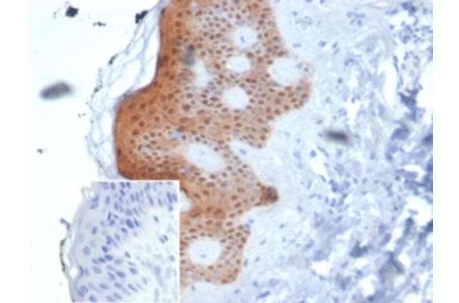 Immunohistochemistry - Anti-Maspin Antibody [SERPINB5/4975] (A277745) - Antibodies.com