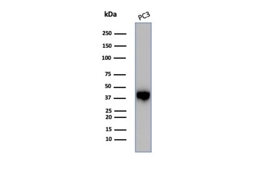 Western Blot - Anti-Maspin Antibody [SERPINB5/4975] (A277745) - Antibodies.com
