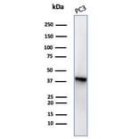 Western Blot - Anti-Maspin Antibody [SERPINB5/4977] (A277746) - Antibodies.com