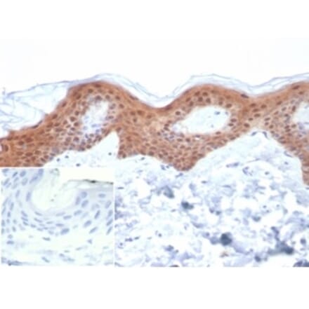 Immunohistochemistry - Anti-Maspin Antibody [SERPINB5/4979] (A277747) - Antibodies.com