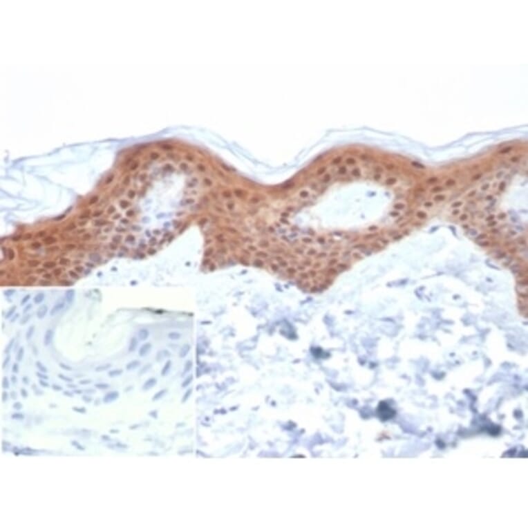 Immunohistochemistry - Anti-Maspin Antibody [SERPINB5/4979] (A277747) - Antibodies.com
