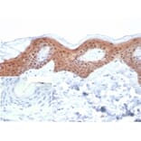 Immunohistochemistry - Anti-Maspin Antibody [SERPINB5/4979] (A277747) - Antibodies.com