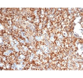 Immunohistochemistry - Anti-PI 3 Kinase p85 beta Antibody [PIK3R2/292] (A277748) - Antibodies.com