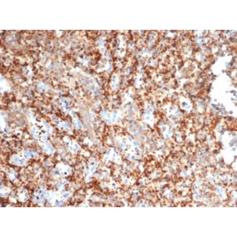 Immunohistochemistry - Anti-PI 3 Kinase p85 beta Antibody [PIK3R2/292] (A277748) - Antibodies.com