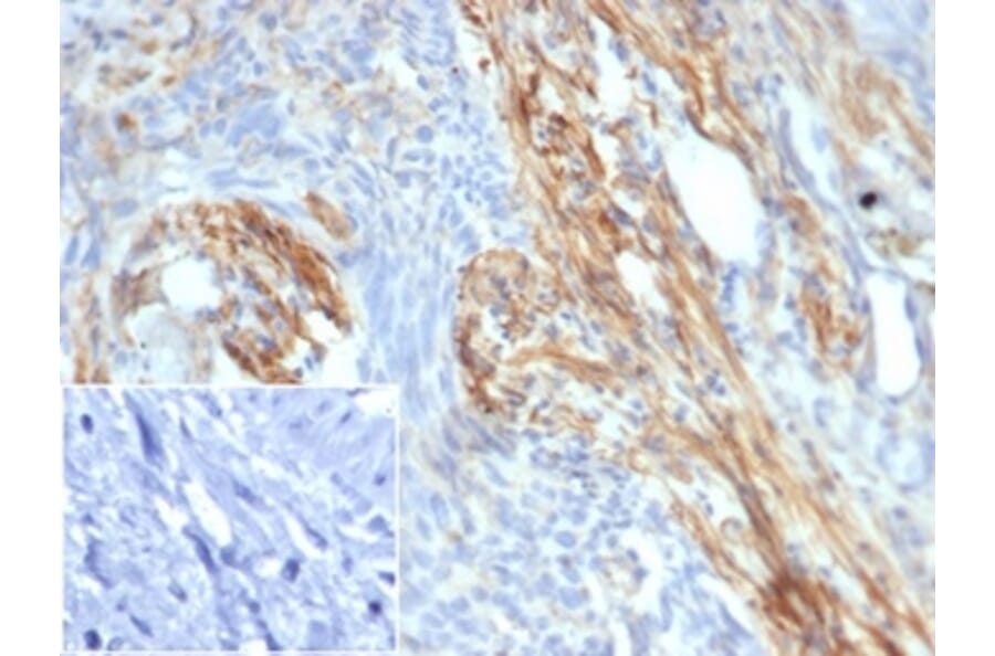 Immunohistochemistry - Anti-PI 3 Kinase p85 beta Antibody [PIK3R2/292] (A277748) - Antibodies.com