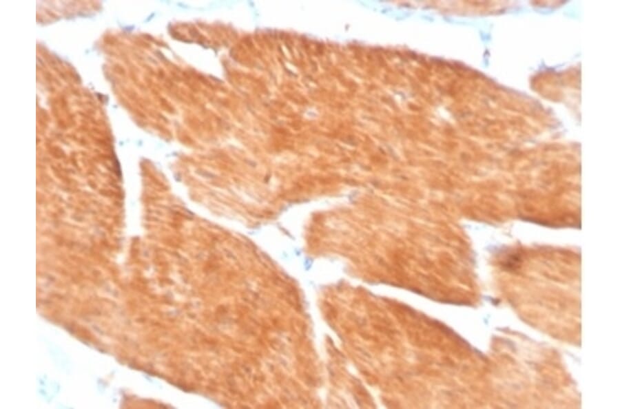 Immunohistochemistry - Anti-PI 3 Kinase p85 beta Antibody [PIK3R2/1293] (A277749) - Antibodies.com