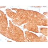 Immunohistochemistry - Anti-PI 3 Kinase p85 beta Antibody [PIK3R2/1293] (A277749) - Antibodies.com