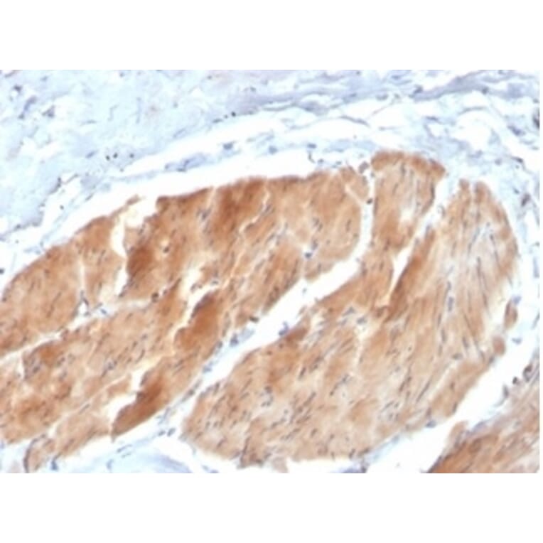 Immunohistochemistry - Anti-PI 3 Kinase p85 beta Antibody [PIK3R2/1293] (A277749) - Antibodies.com