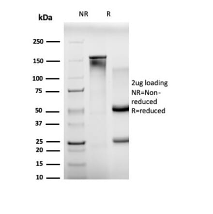 SDS-PAGE - Anti-BCL11A Antibody [PCRP-BCL11A-1H3] (A277751) - Antibodies.com