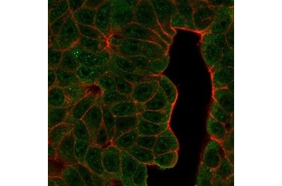 Immunofluorescence - Anti-BCL11A Antibody [PCRP-BCL11A-1H3] (A277751) - Antibodies.com