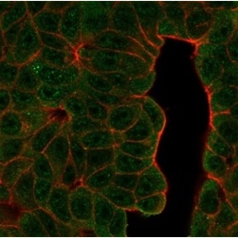 Immunofluorescence - Anti-BCL11A Antibody [PCRP-BCL11A-1H3] (A277751) - Antibodies.com