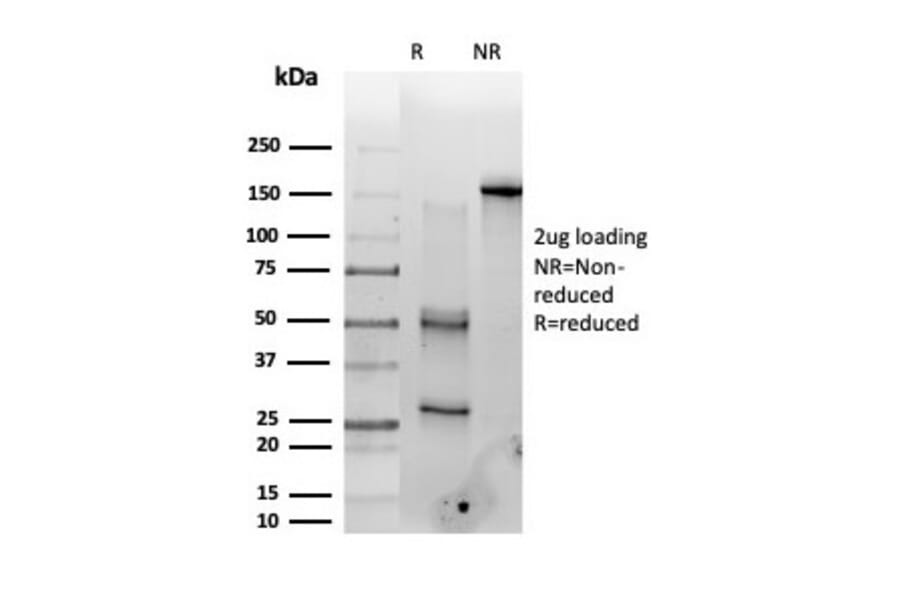 SDS-PAGE - Anti-PMS1 Antibody [PCRP-PMS1-2E11] (A277752) - Antibodies.com