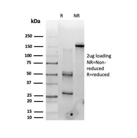 SDS-PAGE - Anti-PMS1 Antibody [PCRP-PMS1-2E11] (A277752) - Antibodies.com