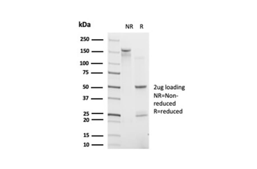 SDS-PAGE - Anti-CHRAC17 Antibody [PCRP-POLE3-3D3] (A277753) - Antibodies.com
